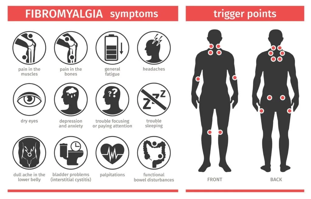 Illustration showing Fibromyalgia symptoms