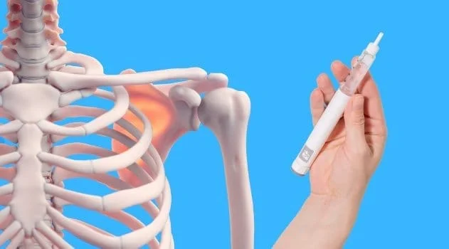 Composite image of skeleton and GLP-1 injection for the blog post on GLP-1 Bone Preservation and Compositional Integrity