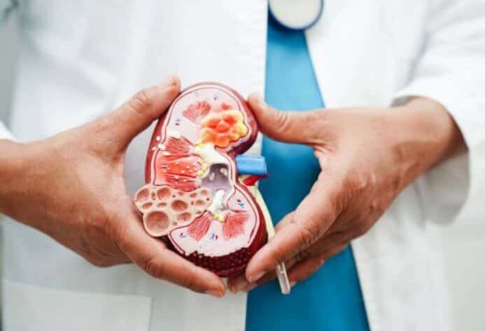 A doctor holding a model of a kidney.