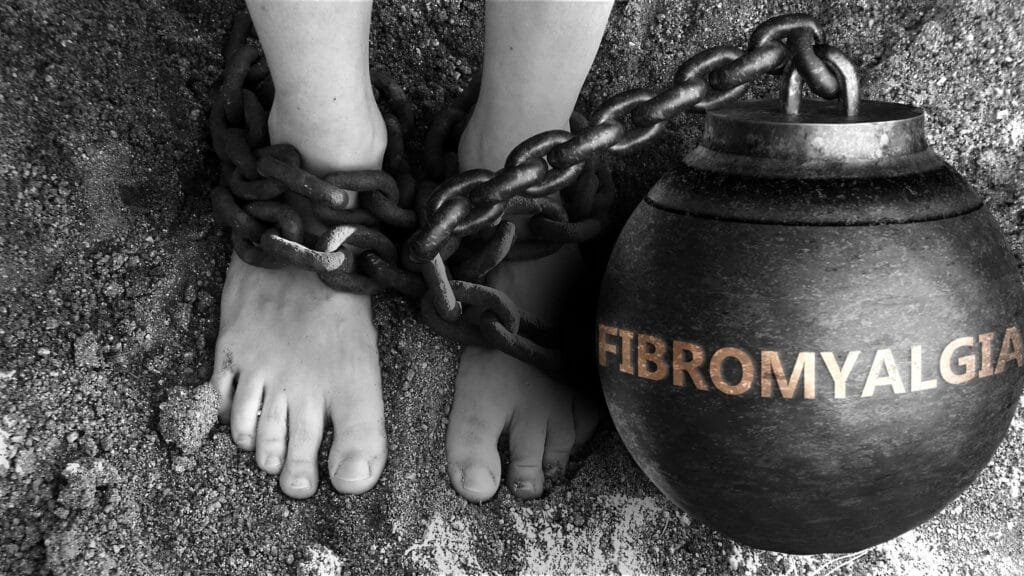 Photo of a person suffering from Fibromyalgia. Their legs are tied to a ball and chain with the word "Fibromyalgia" on the ball