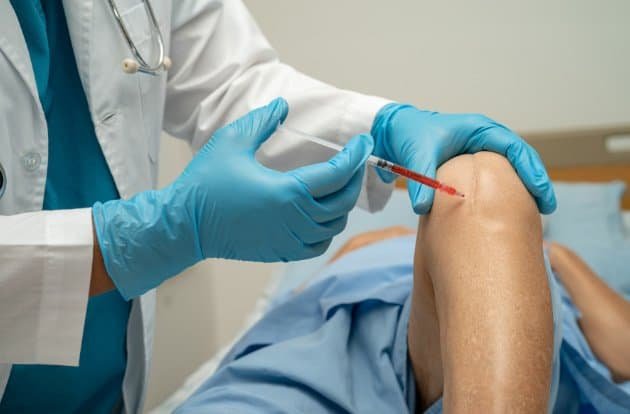 Person receiving BMAC treatment for the blog post on peptides for joint pain in athletes