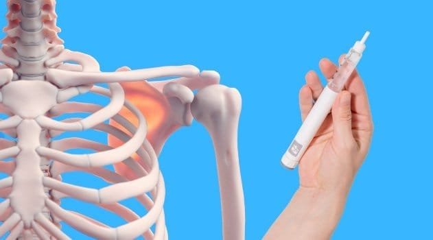 Composite image of skeleton and GLP-1 injection for the blog post on GLP-1 Bone Preservation and Compositional Integrity